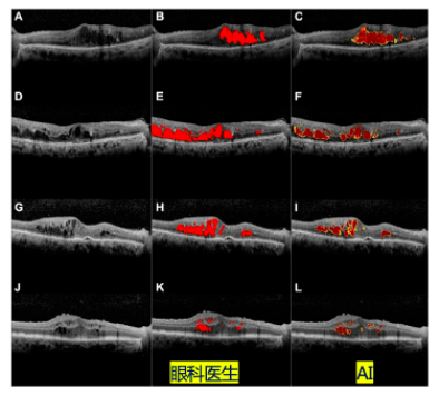 朝聚眼科人工智能战略发布会暨AI眼科医生系统首发仪式召开
