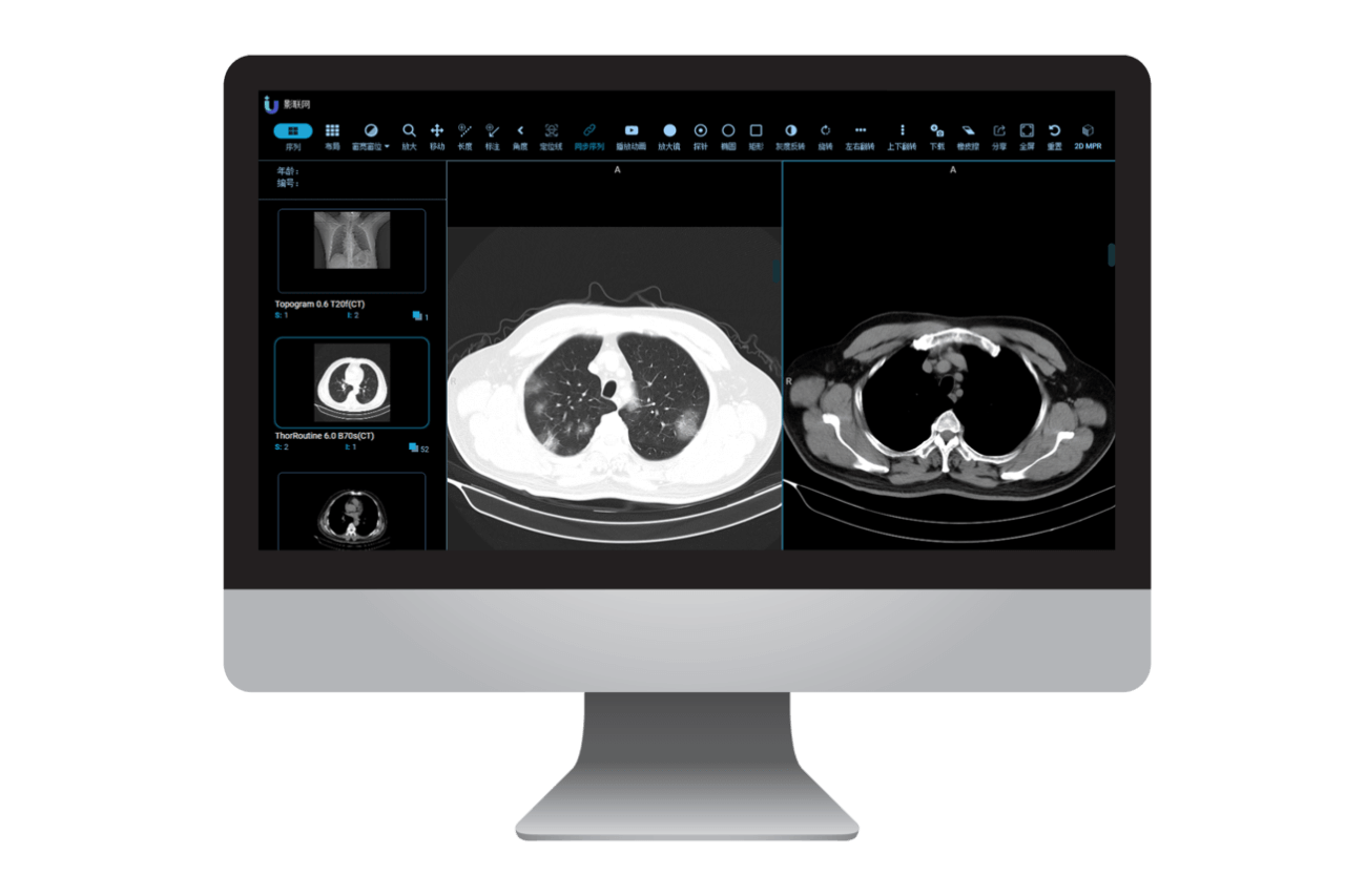医保影像云跨省调阅启动 医学影像开始实现全国“漫游”