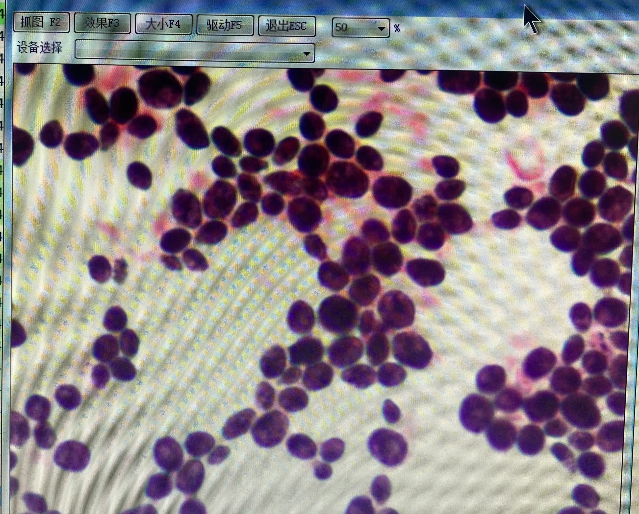 雪榕生物发布自主选育的白色金针菇新菌种